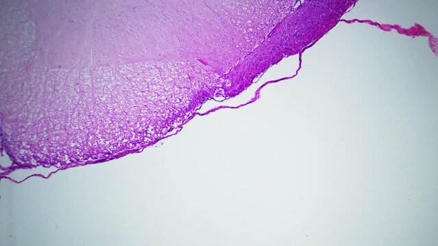 Human nerve fiber bundle under microscope. Cross section. 100x times magnification. Each bundle of nerve fibers is called fasciculus and is surrounded by layer of connective tissue called perineurium