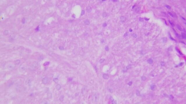 Human nerve bundle under microscope. Cross section. Smooth movement and focusing. Each bundle of nerve fibers is called fasciculus and is surrounded by layer of connective tissue called perineurium