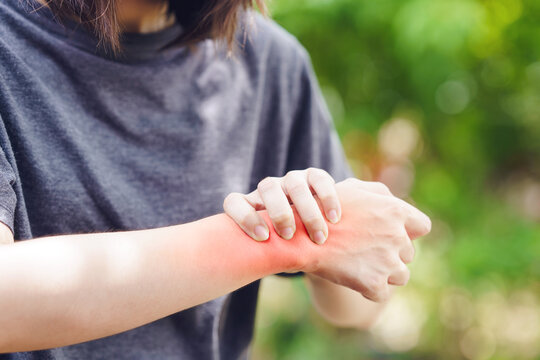 A woman grips her wrist due to a sprain causing inflammation and pain.