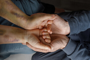 Human hand with bruises in other human hand. Supporting victims of domestic violence. - obrazy, fototapety, plakaty