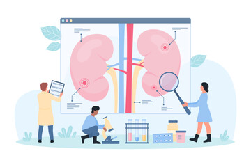 Kidney disease, nephrology vector illustration. Cartoon tiny doctors study science infographic diagram of human kidney with magnifying glass, nephrologists research patients physiology and symptoms