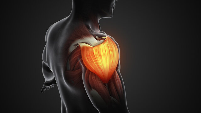 Pain and damage in the shoulder muscles