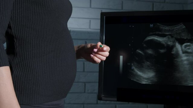 Woman want to stop her pregnancy. A female try to stop her pregnancy with pill.