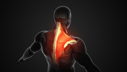 Pain and injury in the Trapezius muscles