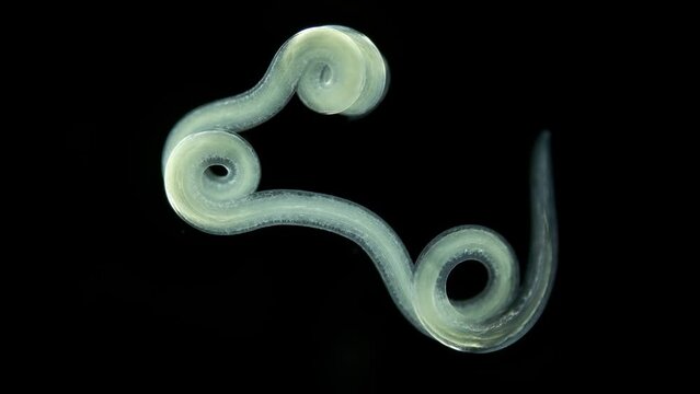 worm Nematoda under microscope, Phylum Protostomia, free-living nematodes inhabit soil, freshwater and sea. Sample found in White Sea