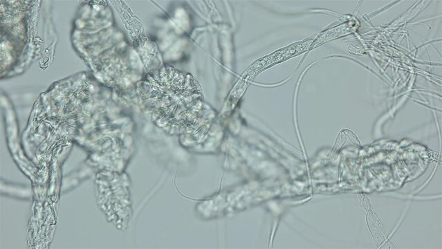 Larvae of parasitic worm Progonus muelleri under a microscope, at Cercaria stage. Class Trematoda. Got out of Sporocyst. White Sea
