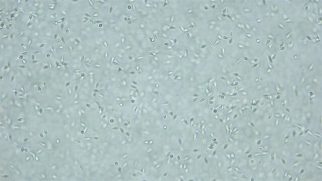 Sperm (spermotozoa) sea urchin Strongylocentrotus pallidus under microscope, phylum Echinodermata. White sea