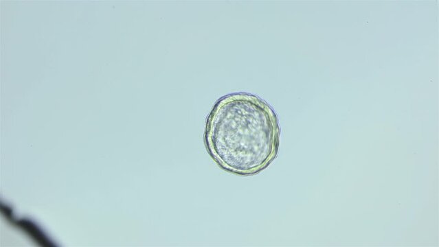 Larva sea urchin Strongylocentrotus pallidus under microscope, phylum Echinodermata. Early blastula stage. White sea