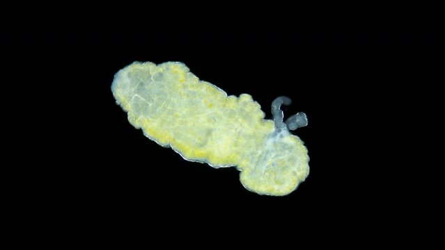 Sporocyst stage of parasitic worm Podocotyle sp. under a microscope, family Opecoelidae. Cercaria larvae emerge through maternity pore. Mollusca host. White Sea