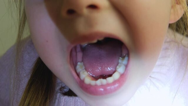 Little girl plays with tongue and saliva. Close-up of a girl open mouth. child shows throat and palate to the doctor. Health concept. Play and stick out your tongue and teeth. Salivation in children.