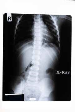 x ray image of a body