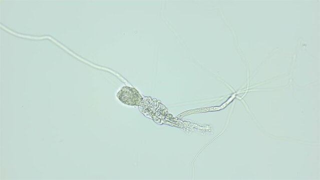 Larva of parasitic worm Progonus muelleri under a microscope, at Cercaria stage. Class Trematoda. White Sea