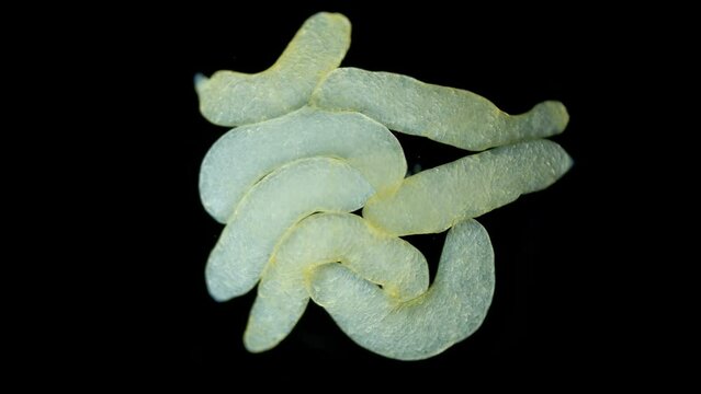 Sporocysts stage of parasitic worm Podocotyle sp. under a microscope, family Opecoelidae. Cercaria larvae develop inside it. Mollusca host. White Sea