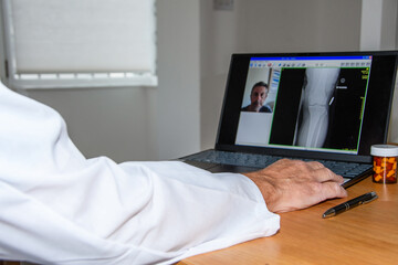  Online GP Doctor's appointment. Consultant working on laptop. Xray of a patient on computer screen whilst in remote chat with DR in hospital or clinic. Focus on keyboard. 