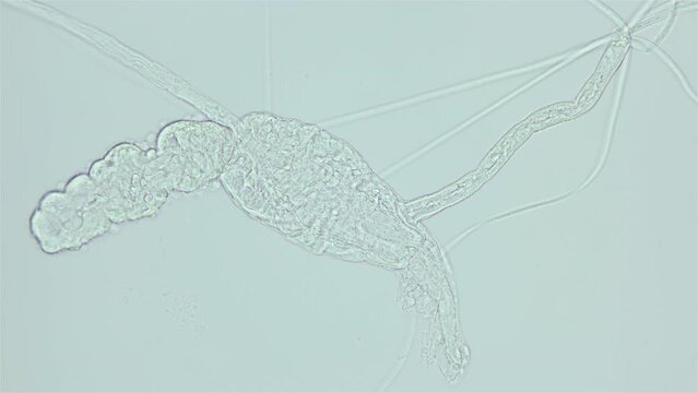 Larva of parasitic worm Progonus muelleri under a microscope, at Cercaria stage. Class Trematoda. White Sea