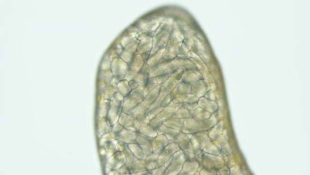 Sporocyst stage of parasitic worm Podocotyle sp. under a microscope, family Opecoelidae. Cercaria larvae develop inside it. Mollusca host. White Sea