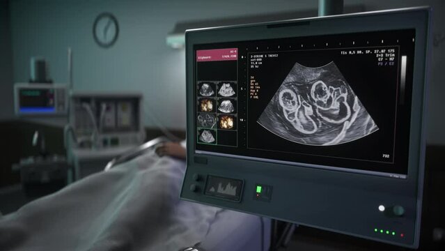 Medical screening machine analysing the condition of pregnant female. Medical screening analysis detects two babies in the stomach. Medical screening analysis identifies identical twins in the belly.