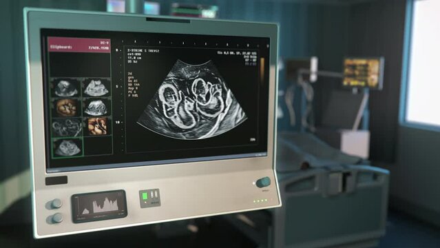 Medical x-ray device detects twin babies in the pregnant woman at the clinic. Medical x-ray device showing the children inside the belly. Medical x-ray device analysing the twins health.