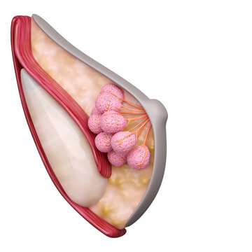 Breast implant augmentation insert silicone gel with subpectoral technique, 3D rendering.