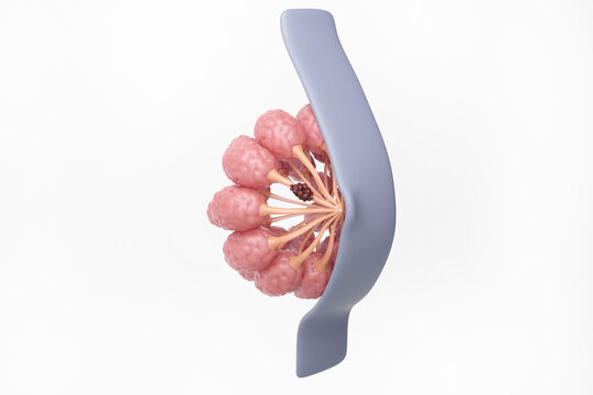 Breast cancer cells at milk ducts, Ductal carcinoma in situ isolated white background, woman medical and treatment, 3D rendering.