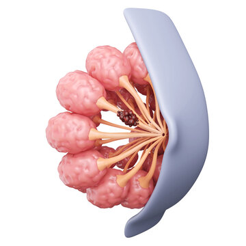 Breast cancer cells at milk ducts, Ductal carcinoma in situ isolated white background, woman medical and treatment, 3D rendering.