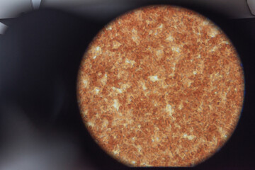 Blood picture, close-up