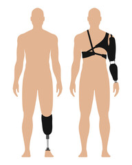 Man with prosthetic arm and leg, medical vector illustration set, isolated on white background. - obrazy, fototapety, plakaty