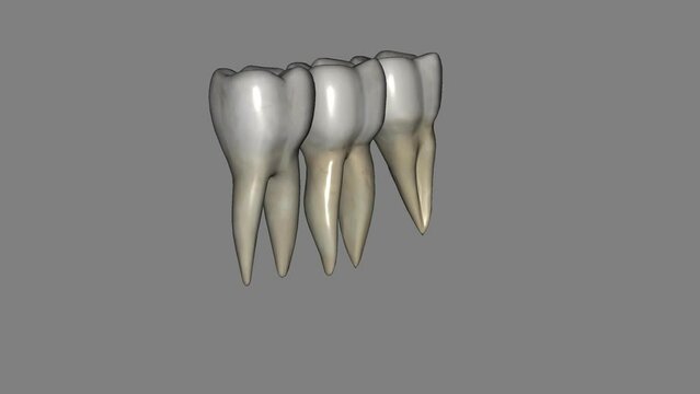 The mandibular first molar usually has two roots, a mesial and a distal .
