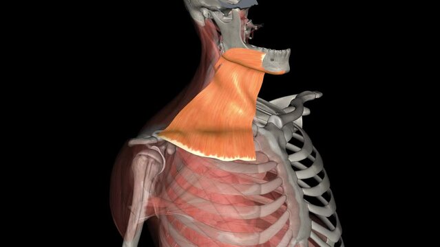 The platysma muscle is a superficial muscle of the human neck that overlaps the sternocleidomastoid .