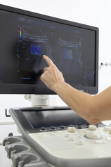 Ultrasonic examination of internal organs. A man on an abdominal ultrasound scan. Apparatus for ultrasonic examination. Modern ultrasound machine. 