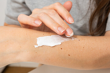 A hand applies white cream to the forearm, highlighting the concept of topical therapy and skincare. 