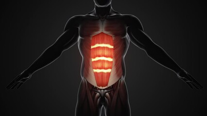 Pain and injury in the abdominal Muscles