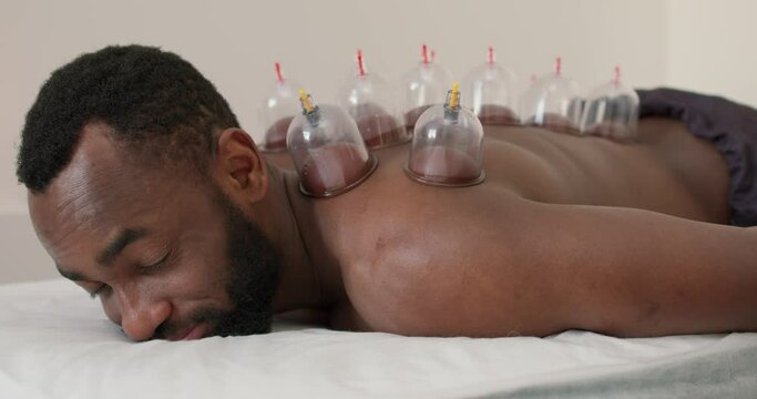 happy handsome black man enjoying cupping therapy and spa healthcare, blood flow or skincare healing to relief back pain or relaxation at resort. Slow motion, relaxed patient looking at camera