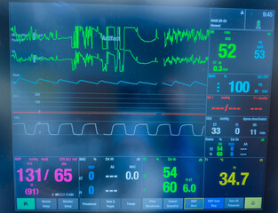 hospital monitor displaying vital signs: heart rate, blood pressure, temperature, and pulse oximetry, highlighting advanced medical technology in patient care