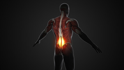 Fibromyalgia or medical conditions of back pain