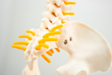 Lumbar spine displaced herniated disc fragment, spinal nerve and bone. Model for treatment medical...
