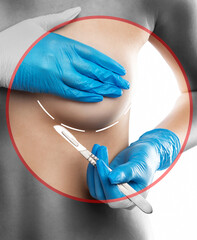 Beautiful young girl with a beautiful body. Woman before breast augmentation surgery. Correction of...
