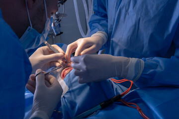 Blepharoplasty, plastic surgery operation for correcting defects, deformities, and disfigurations...