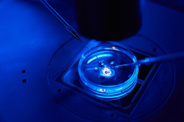 Closeup of intracytoplasmic sperm injection being performed in Petri dish