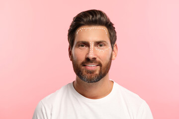 Man with markings for cosmetic surgery on his face against pink background