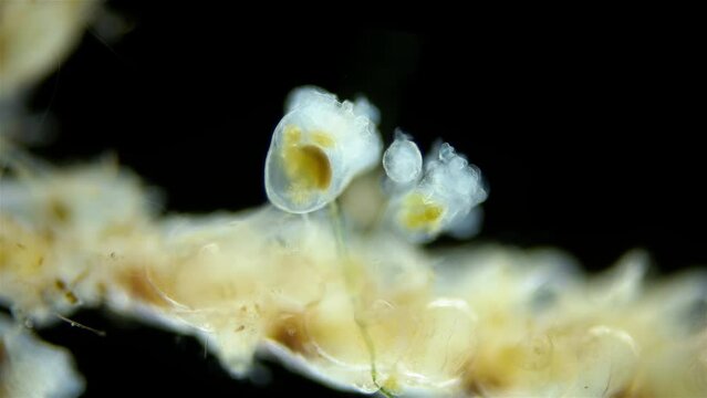 Entoprocta (Kamptozoa) family Pedicellinidae under a microscope, living in sea either singly or in colonies, were formerly considered a subclass of bryozoans. White Sea