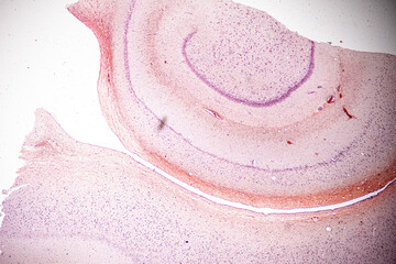 Motor Neuron, Spinal cord, Nerve fibres and nerve cells under the microscope in Lab.