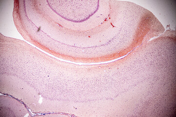 Motor Neuron, Spinal cord, Nerve fibres and nerve cells under the microscope in Lab.