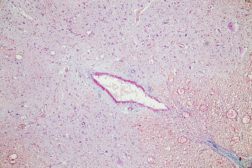 Motor Neuron, Spinal cord, Nerve fibres and nerve cells under the microscope in Lab.