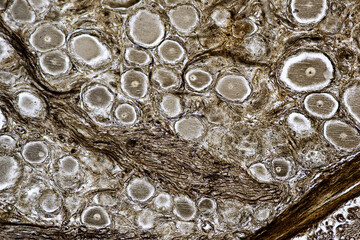 Motor Neuron, Spinal cord, Nerve fibres and nerve cells under the microscope in Lab.