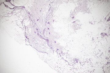 Motor Neuron, Spinal cord, Nerve fibres and nerve cells under the microscope in Lab.