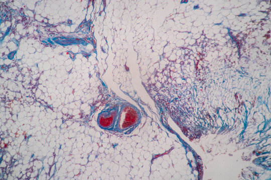 Showing Light micrograph Type of Tissue Human under the microscope in Lab.