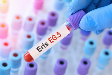 Doctor holding a test blood sample tube for the detection of the new Omicron variant Eris EG.5 on...