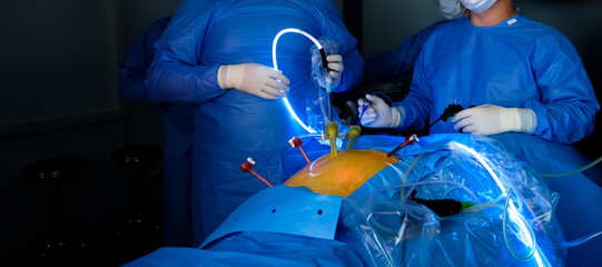 A team of surgeons performs laparoscopic surgery. Bright illumination in the patient's abdominal...