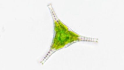 Freshwater microalgae, Staurastrum sp. Live cell. 2480x magnification (400x6.2). Stacked photo